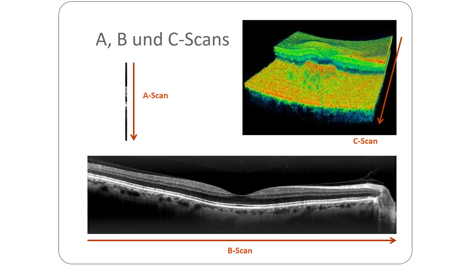 Optical coherence tomography Optische Kohärenztomographie Caroline Truckenbrod MDAV