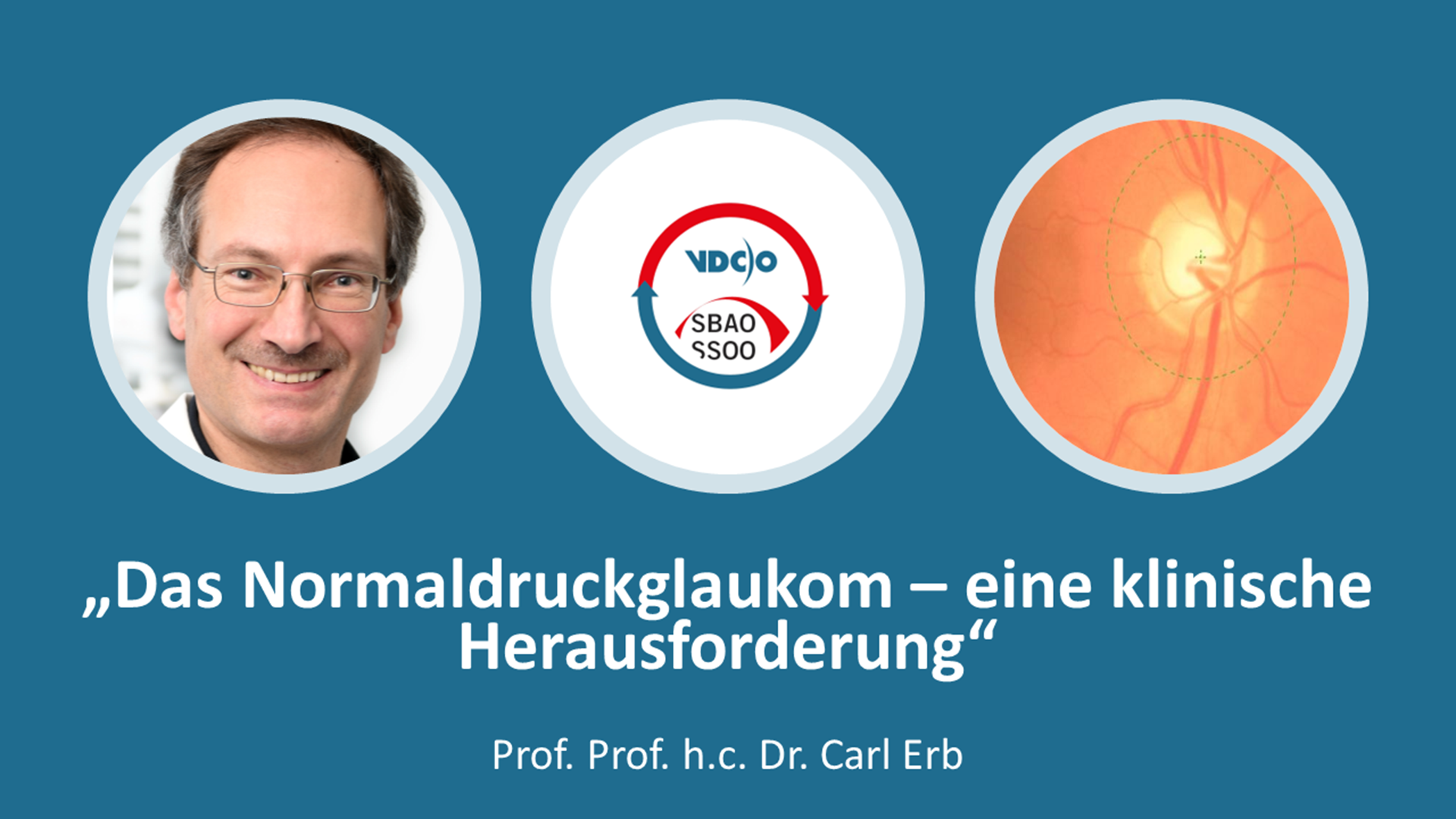 VDCO SBAO Webinar Das Normaldruckglaukom - eine klinische Herausforderung Carl Erb