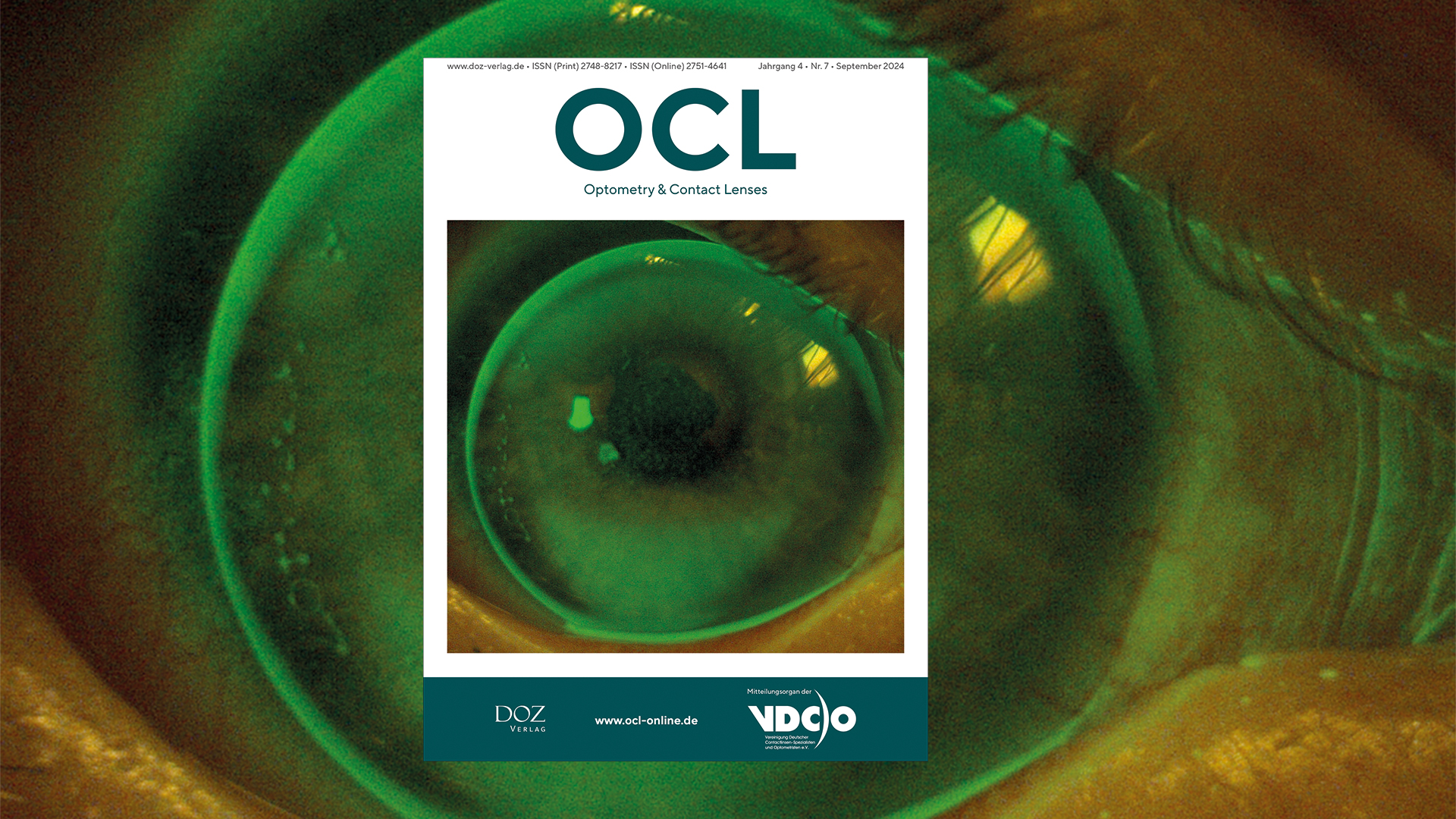 OCL Cover