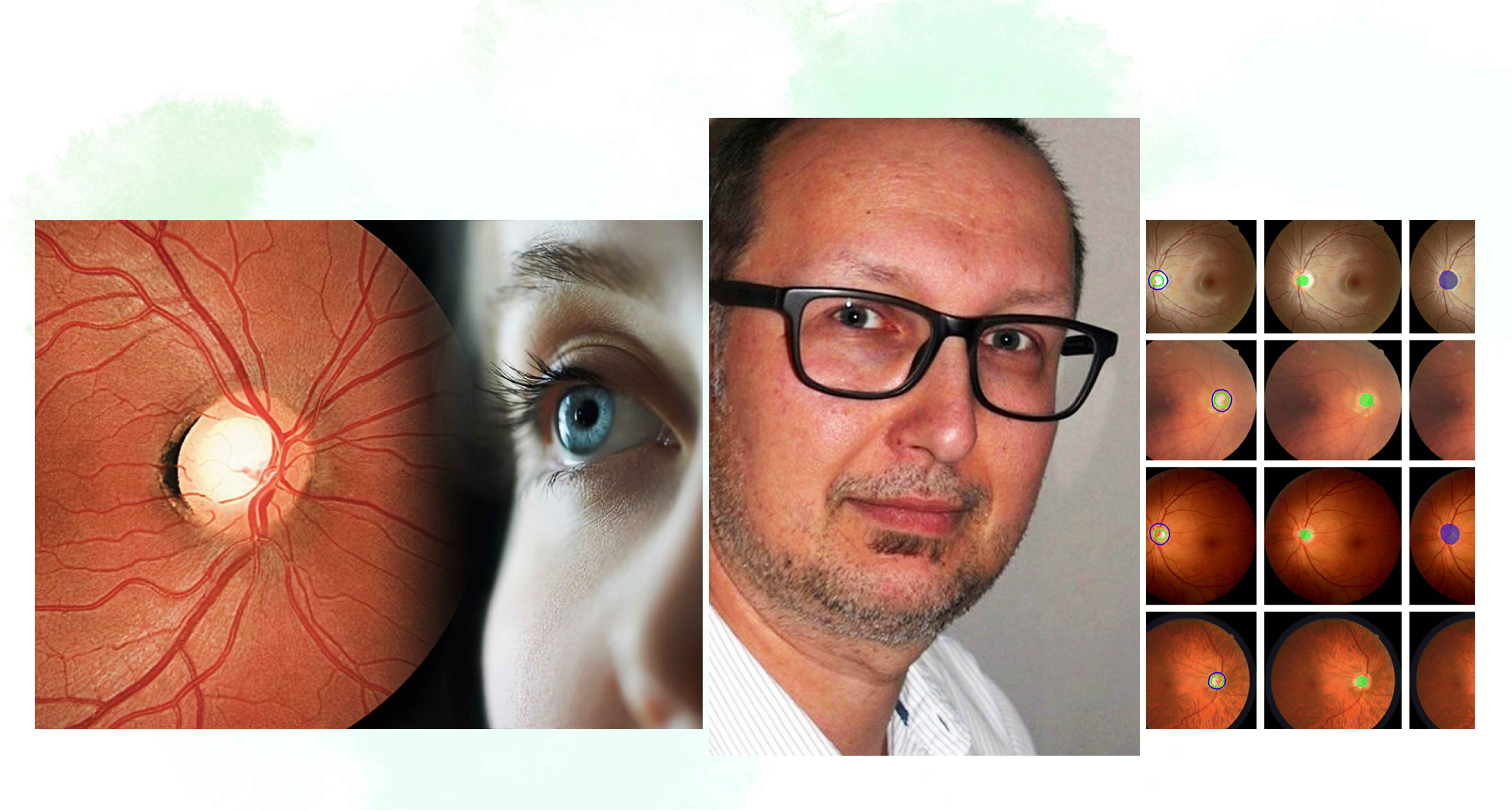 WVAO Seminar Fundus 1