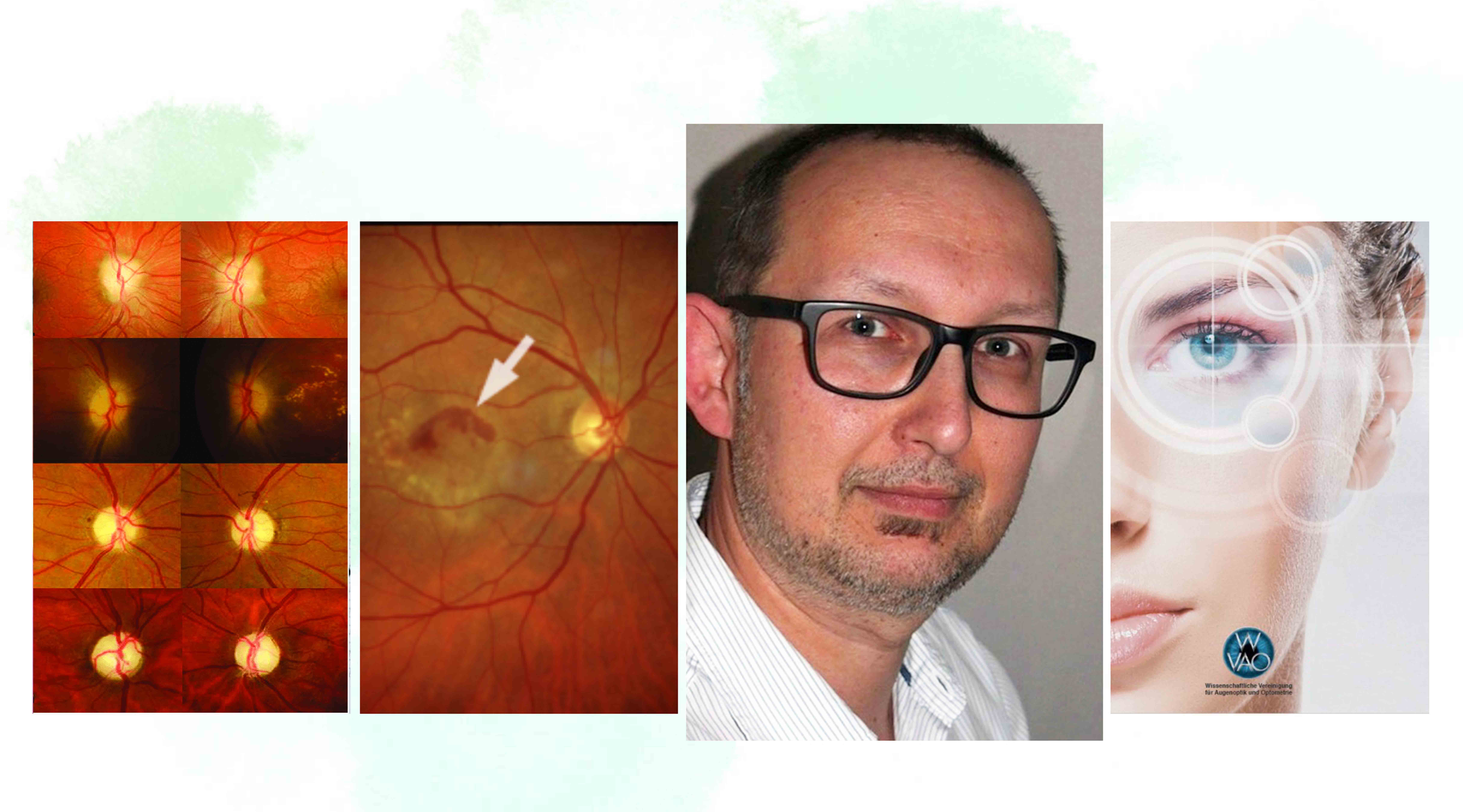 WVAO Seminar Fundus 2
